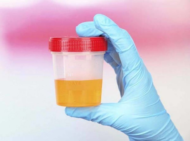 Rasedustesti uriiniga