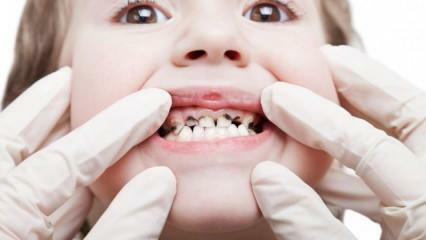 Tee oma lapse hambaravi semestri jooksul korda!