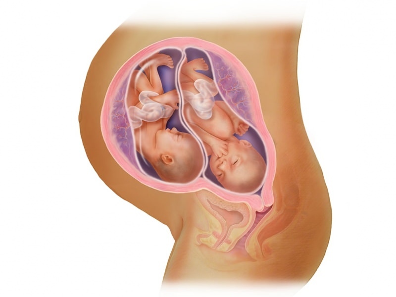 Kaksikute rasedus IVF-is! Mis on embrüo siirdamine?