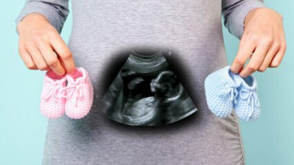 Kas lapse sugu määratakse raseduse esimesel trimestril?