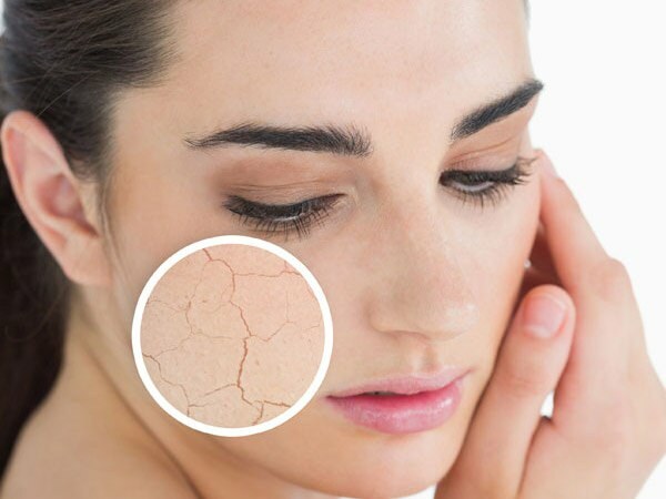 Miks nahk kuivab? Mida teha kuivale nahale? Kõige tõhusamad kuiva naha hooldussoovitused
