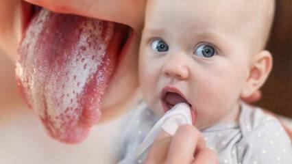 Imikute ripsmehaiguse sümptomid ja ravi! Kuidas imikutele antakse rähn? Täpne lahendus ...