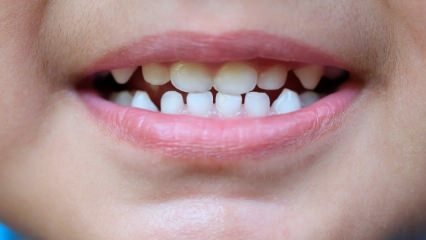 Kuidas õpetada lastele hambaravi?