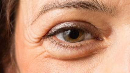 Kuidas silmaalused kotid mööduvad? 10 parimat silmaümbruse kreemi