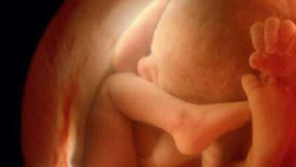 Beebi sugu ultrahelis näitamata jätmine! Kuidas imikud ja tüdrukud ultrahelis välja näevad?