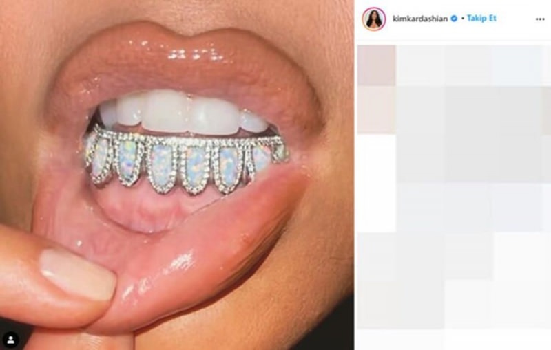 Kim Kardashiani 5000 dollari suurune hambakivi