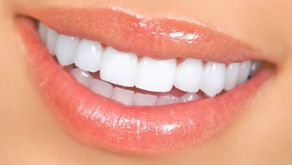 Looduslikud hammaste valgendamise meetodid