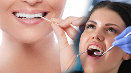 Kuidas hoida suu ja hammaste tervist? Mida tuleks hammaste puhastamisel arvestada?