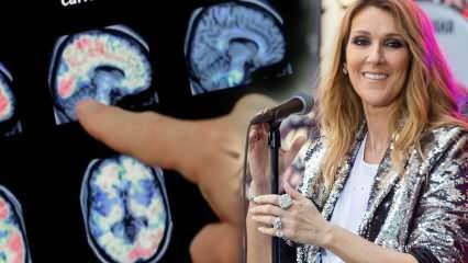 Mis on jäiga inimese sündroom? Celine Dion