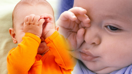 Looduslikud lahendused imikute silmapõletuseks