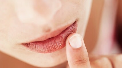 Kuidas peaks huulte hooldus olema raseduse ajal?