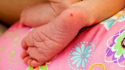 Miks võetakse kanna verd imikutel? Nõuded kanna vereanalüüsi tegemiseks imikutel