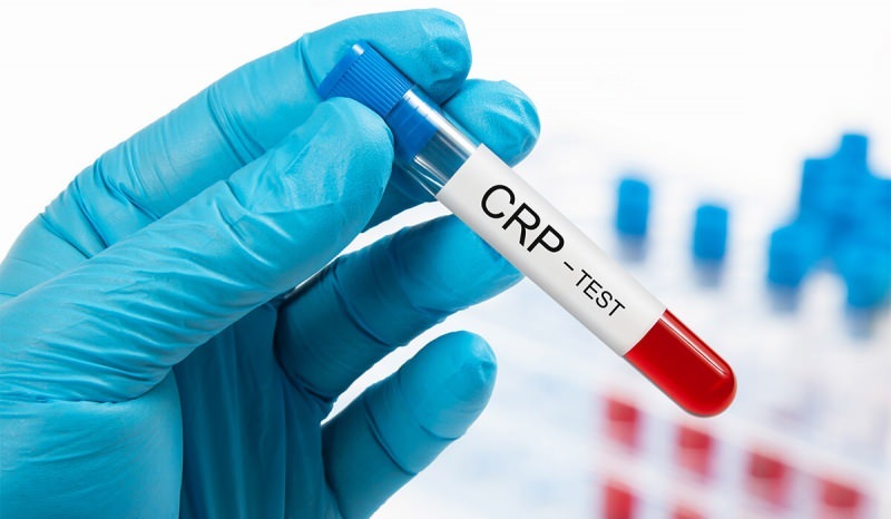 Miks CRP veres tõuseb? Mis on CRP? Kuidas vähendada CRP-d?