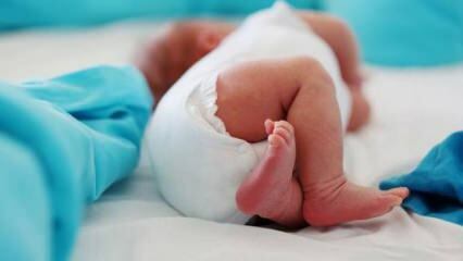 Kas beebidel peaks olema puusa ultraheli?