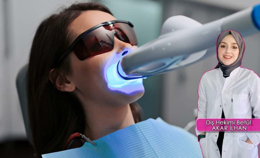 Kuidas toimub hammaste valgendamise (pleegitamise) meetod? Kas pleegitamismeetod kahjustab hambaid?
