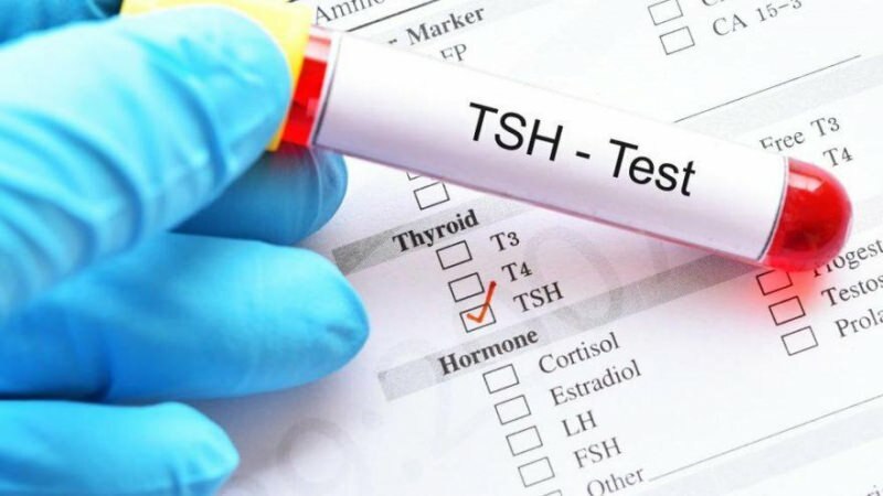 tsh-test on hormoonanalüüs