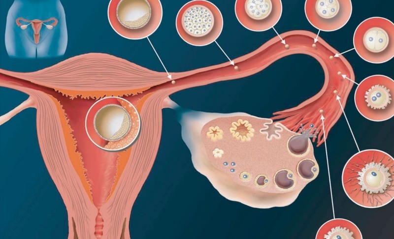 Mis on implantatsioon? Kuidas eristada verejooksu menstruaalverejooksust? Värvus ja konsistents ...