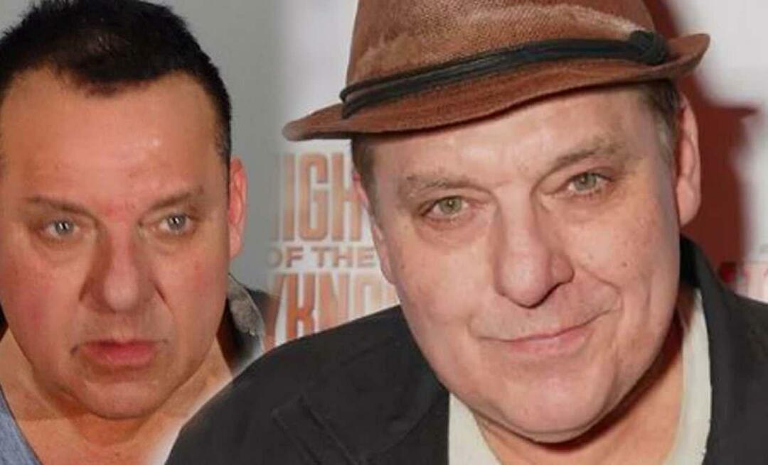 Tom Sizemore suri aju aneurüsmi!