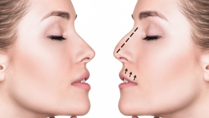 Millised on kodus nina vähendamise meetodid? Nina kokkutõmbamise harjutused