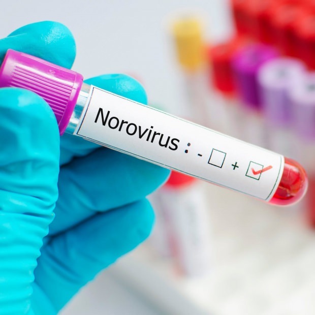 Mis on noroviirus ja milliseid haigusi põhjustab