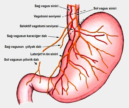 STOMACH FELCTI SÜMPTOMID