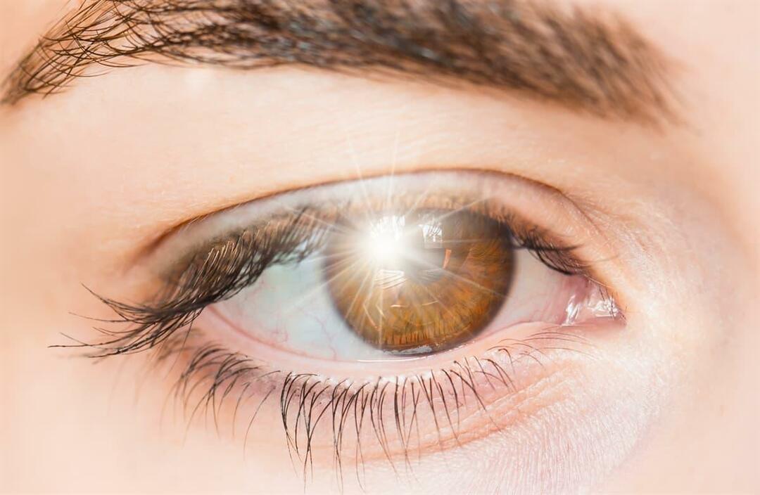 Mis põhjustab valgussähvatusi silmas ja kuidas seda ravitakse?
