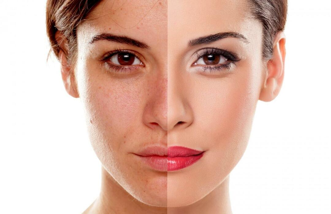 Kuidas vältida naha väsinud väljanägemist? Kuidas vähendada naha väsinud välimust?