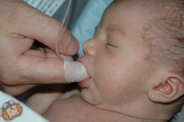 Mis on sõrmede söötmise meetod? Kuidas toita last süstlaga?