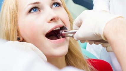 Kas hammaste ekstraheerimine on raseduse ajal?