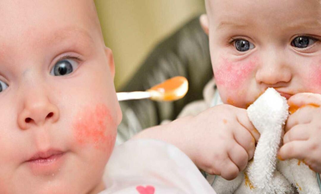 Mida peaks sööma allergiline laps? Millised on alternatiivsed toidud allergilistele imikutele?