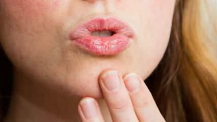 Kuidas kodus huulehooldust teha? Lihtne kuivade huulte hooldus neljas etapis
