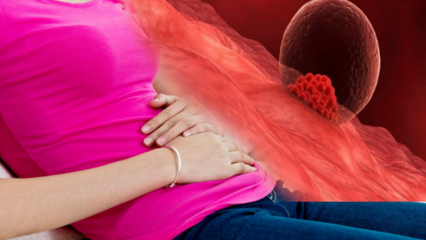 Mis on implantatsiooniverejooks raseduse ajal? Kuidas teha vahet implantatsiooniverejooksu ja menstruatsiooniverejooksu vahel
