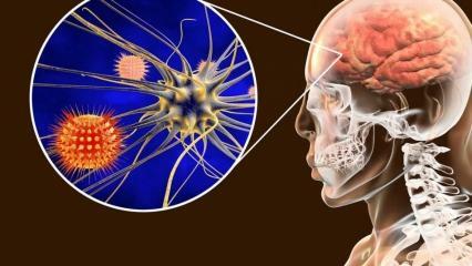 Mis on meningiit ja millised on selle sümptomid? Kas meningiidi raviks on olemas?